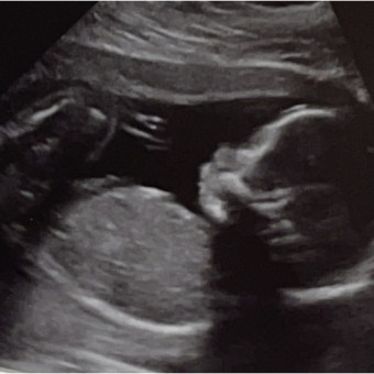 Babylist Registry Photo.
