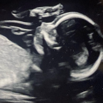 Babylist Registry Photo.