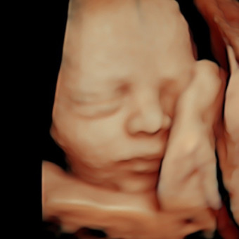 Babylist Registry Photo.