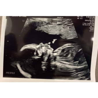 Babylist Registry Photo.