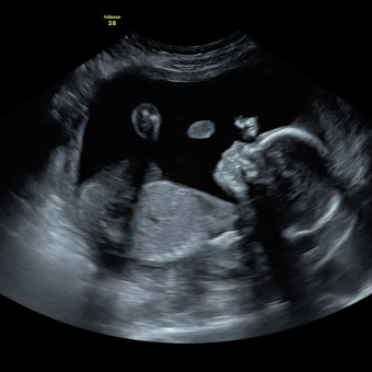 Babylist Registry Photo.