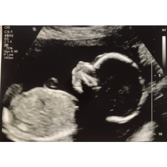 Babylist Registry Photo.