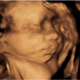 Babylist Registry Photo.