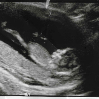 Babylist Registry Photo.