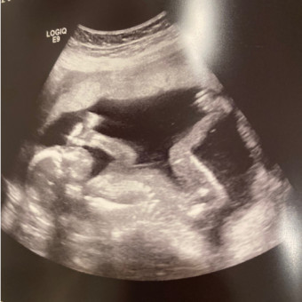 Babylist Registry Photo.