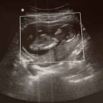Babylist Registry Photo.