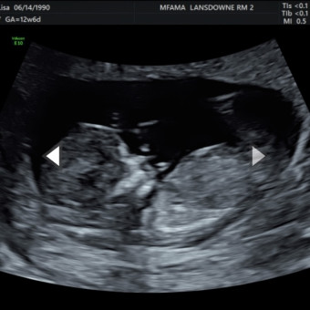 Babylist Registry Photo.