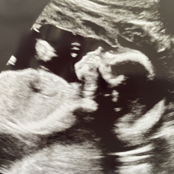 Babylist Registry Photo.