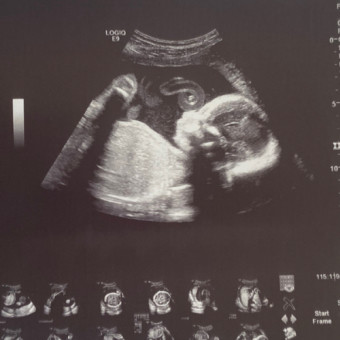 Babylist Registry Photo.