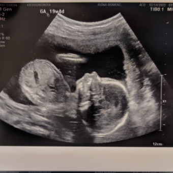Babylist Registry Photo.