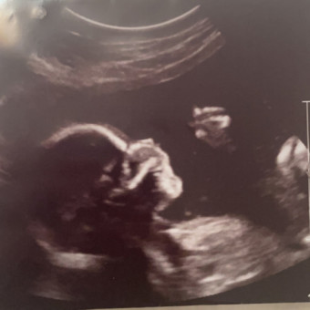 Babylist Registry Photo.