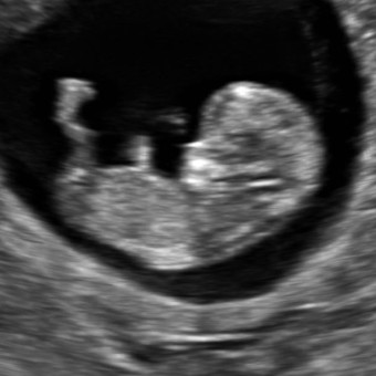 Babylist Registry Photo.