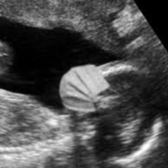 Babylist Registry Photo.