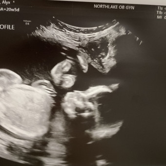 Babylist Registry Photo.