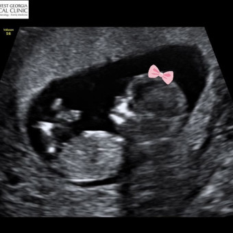 Babylist Registry Photo.