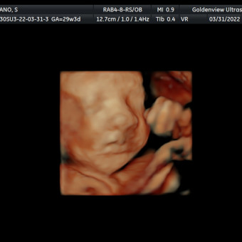 Babylist Registry Photo.