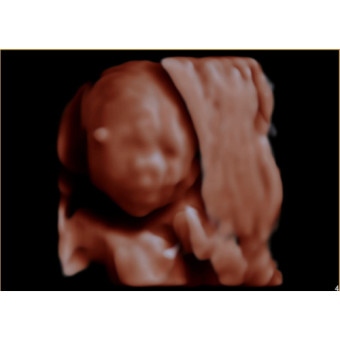 Babylist Registry Photo.