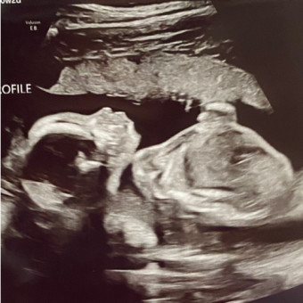 Babylist Registry Photo.