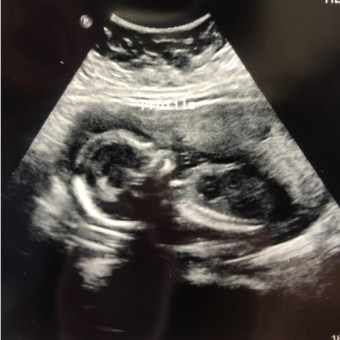 Babylist Registry Photo.