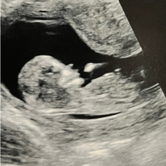 Babylist Registry Photo.