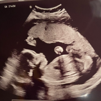 Babylist Registry Photo.
