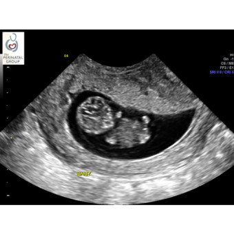 Babylist Registry Photo.