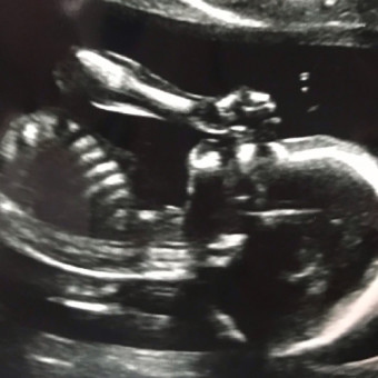 Babylist Registry Photo.