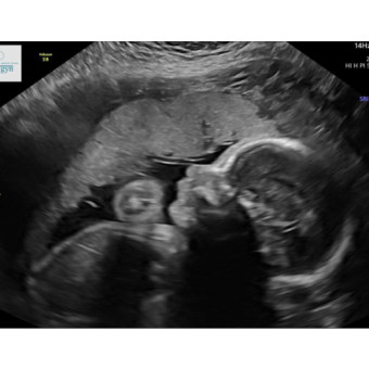 Babylist Registry Photo.