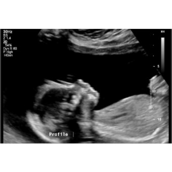 Babylist Registry Photo.