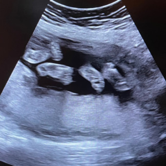 Babylist Registry Photo.