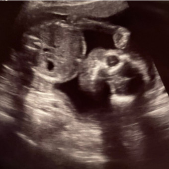 Babylist Registry Photo.
