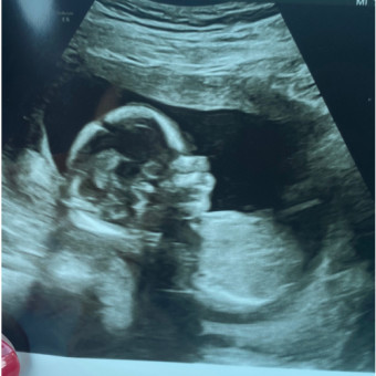 Babylist Registry Photo.