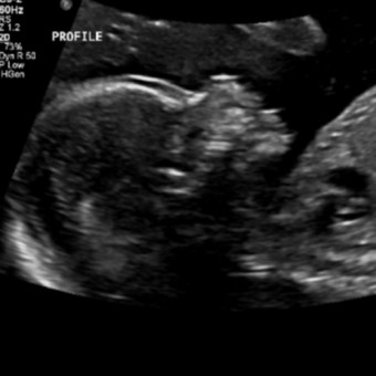 Babylist Registry Photo.