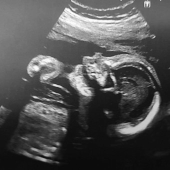Babylist Registry Photo.