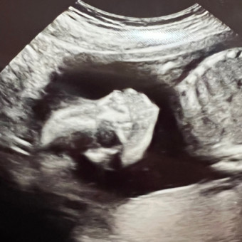 Babylist Registry Photo.