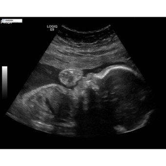 Babylist Registry Photo.