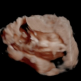 Babylist Registry Photo.