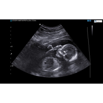 Babylist Registry Photo.