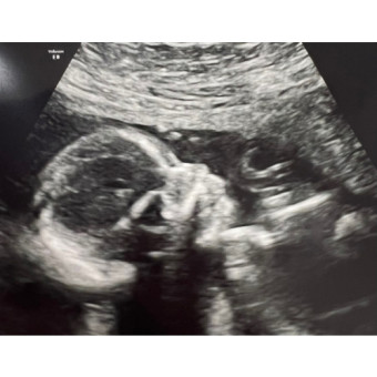 Babylist Registry Photo.