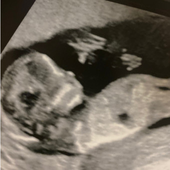 Babylist Registry Photo.