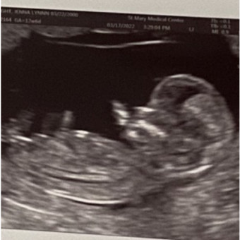 Babylist Registry Photo.