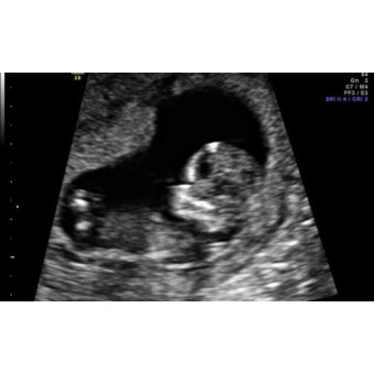 Babylist Registry Photo.