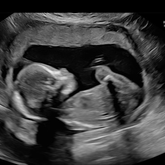 Babylist Registry Photo.