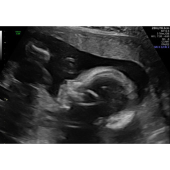 Babylist Registry Photo.
