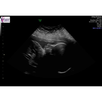 Babylist Registry Photo.