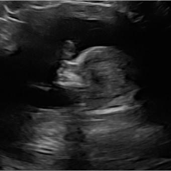 Babylist Registry Photo.