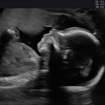 Babylist Registry Photo.