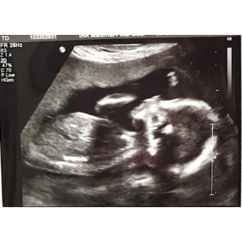 Babylist Registry Photo.