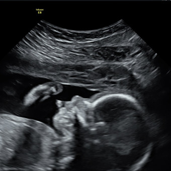Babylist Registry Photo.