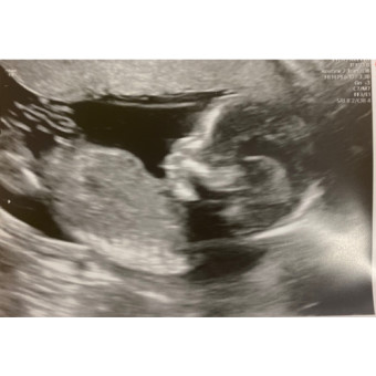 Babylist Registry Photo.